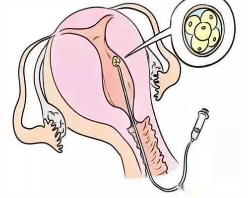 供卵试管论坛_供卵全过程,2026
湖北省供卵机构排名，试管供卵助孕攻略参考