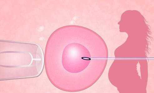 找人代生孩子触发吗,试管婴儿长方案、短方案、拮抗剂方案流程步骤科普_试管